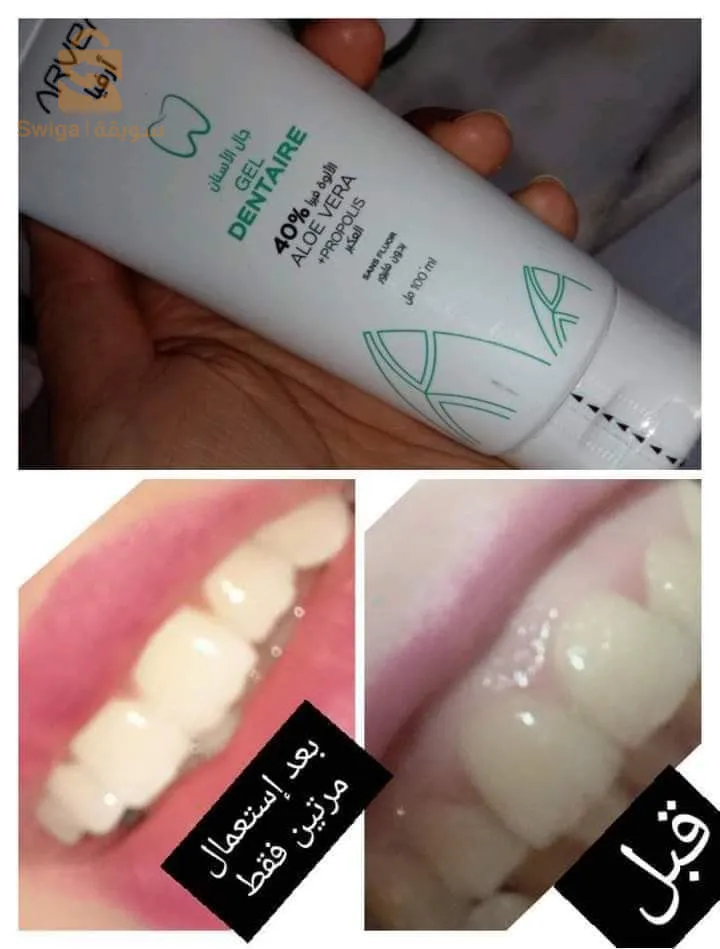 جال الاسنان