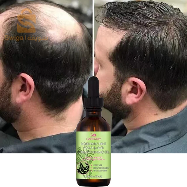 اكليل الجبل ضد التساقط الشعر