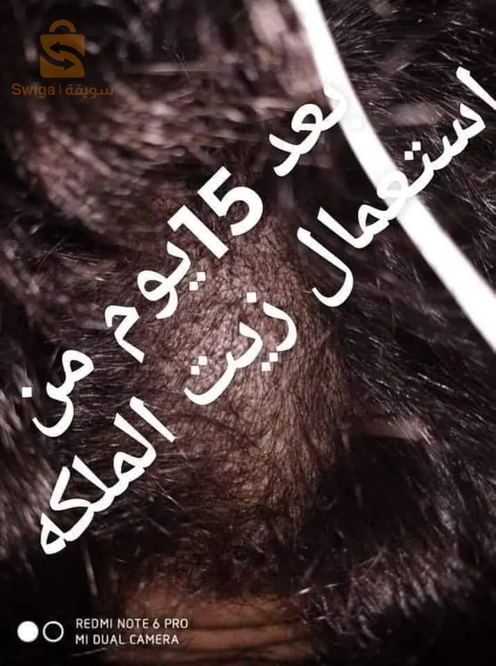 زيت الملكة لمشاكل الشعر
