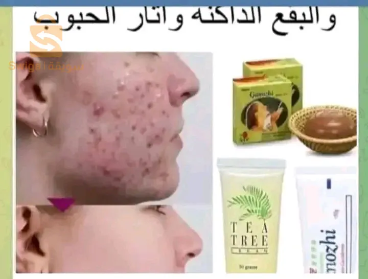 الجزائر