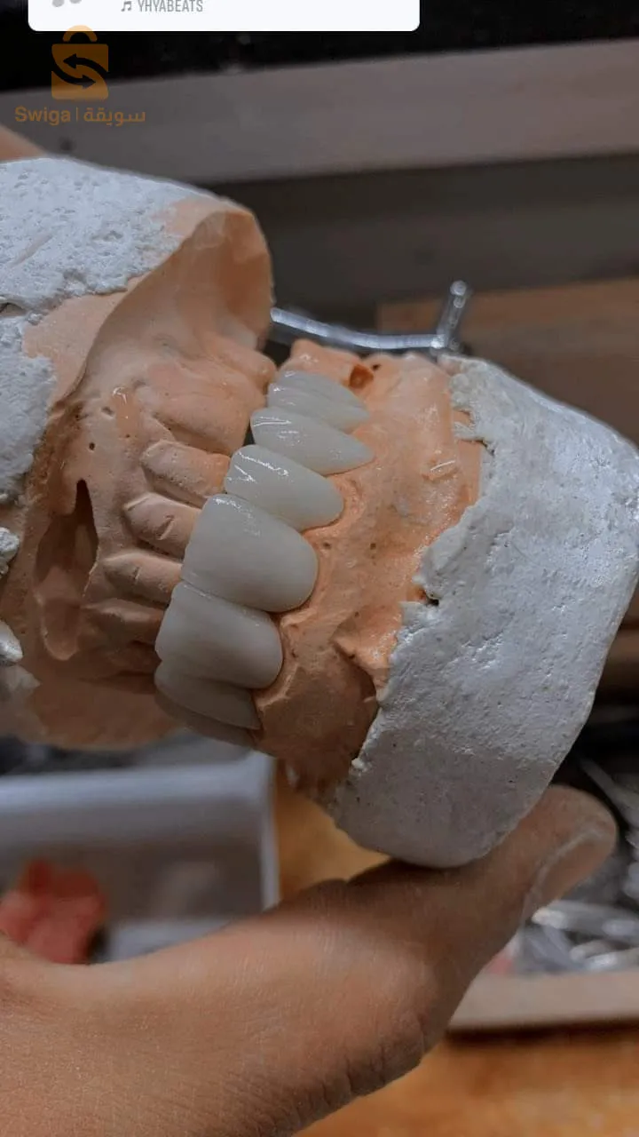 la prothèse dentaire