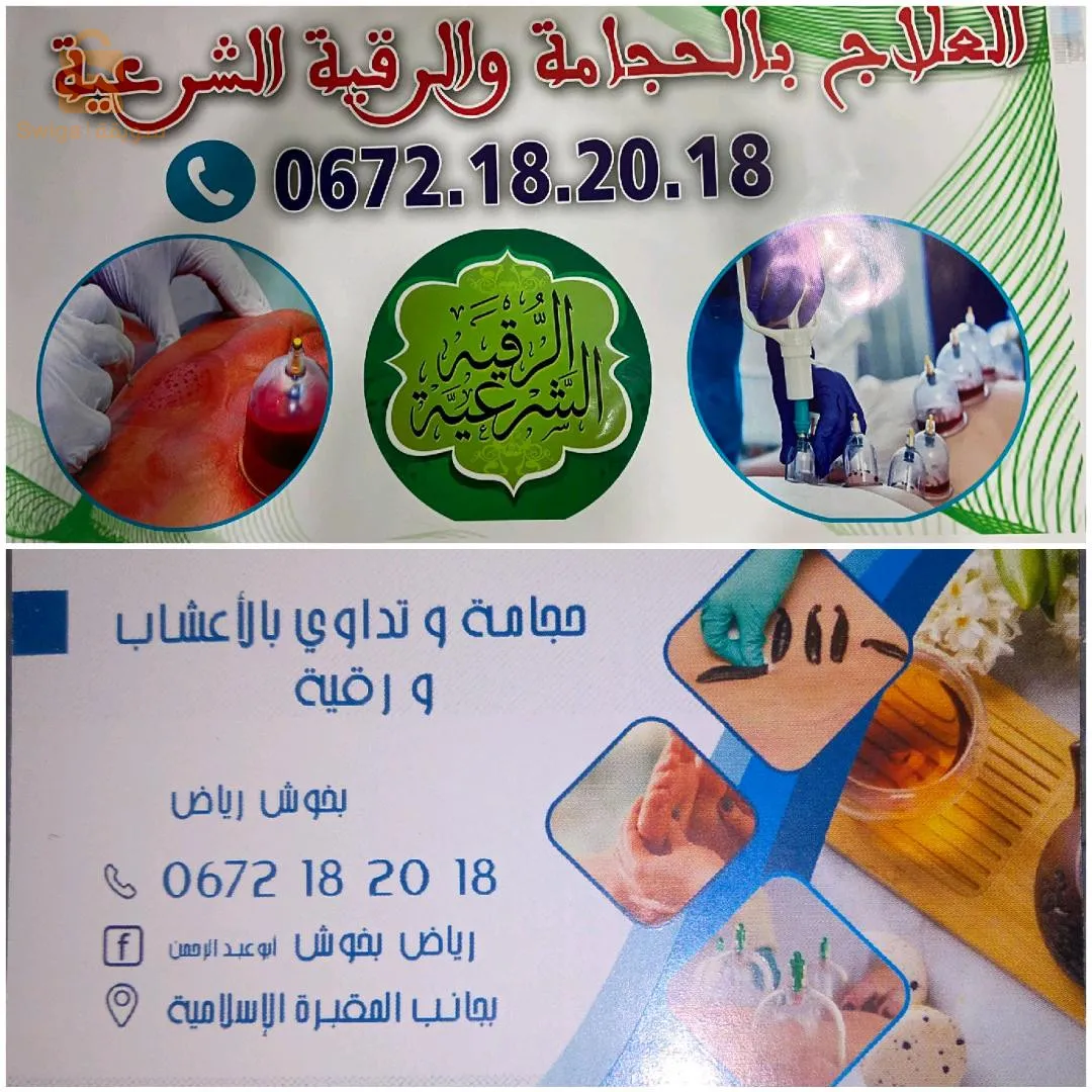 حجامة علاجية