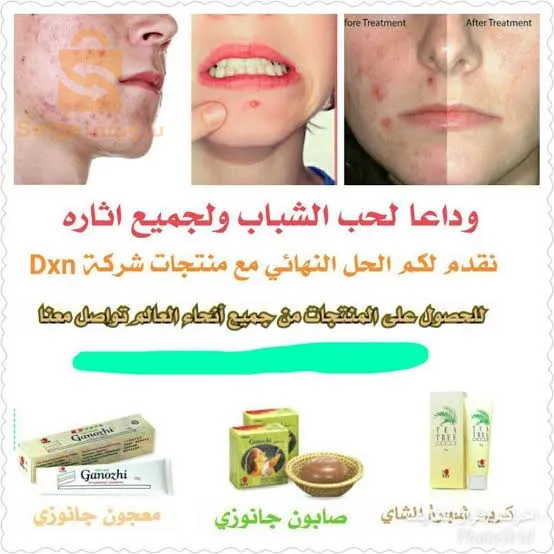 لجمال بشرتك مع صابون جانوزي