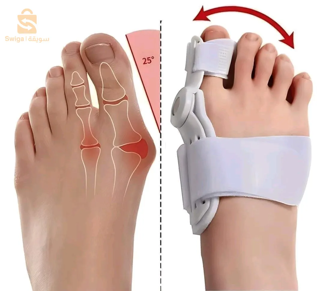 مصحح اعوجاج اصبع القدم