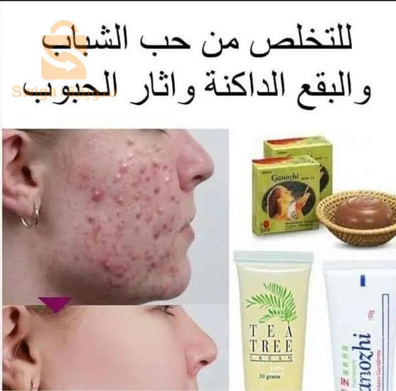 لجمال بشرتك مع صابون جانوزي