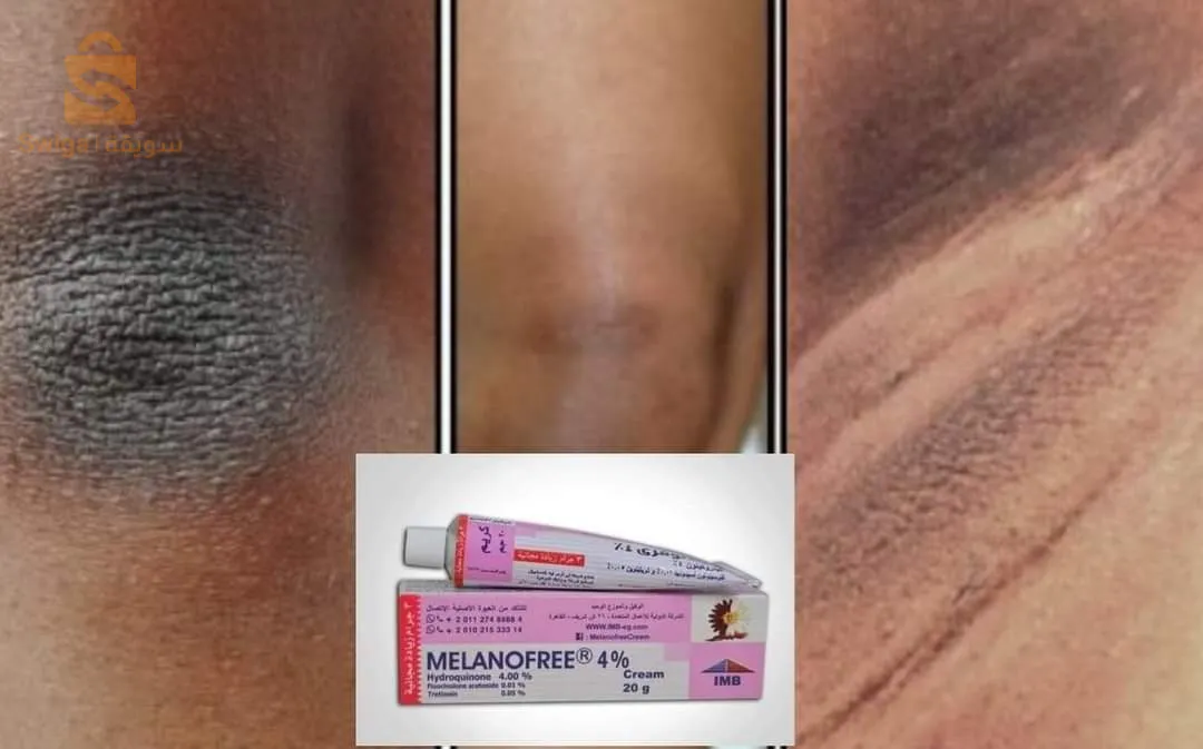 Cream Melanofree 4% 20g