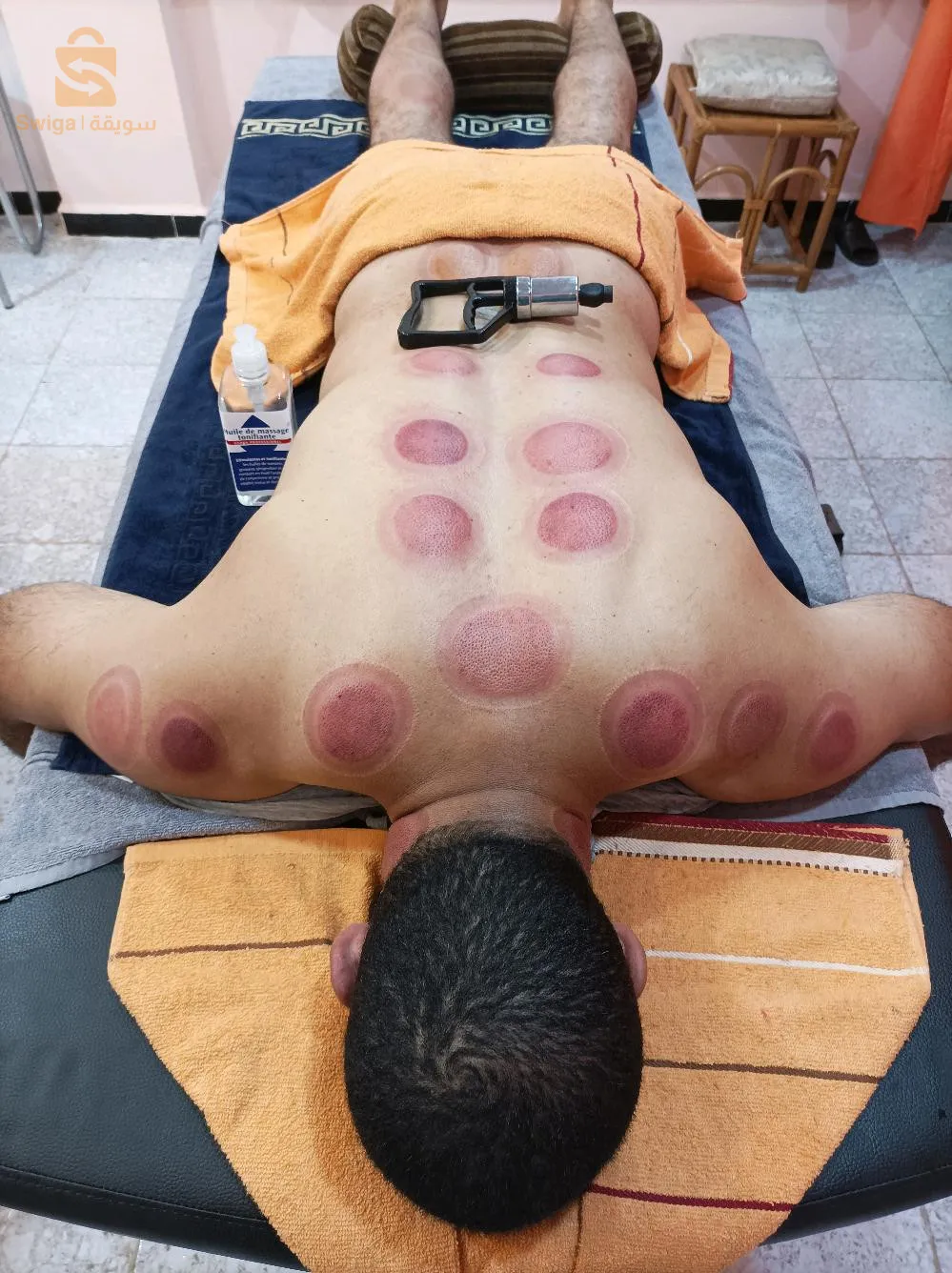 حجامة علاجية للرياضيين