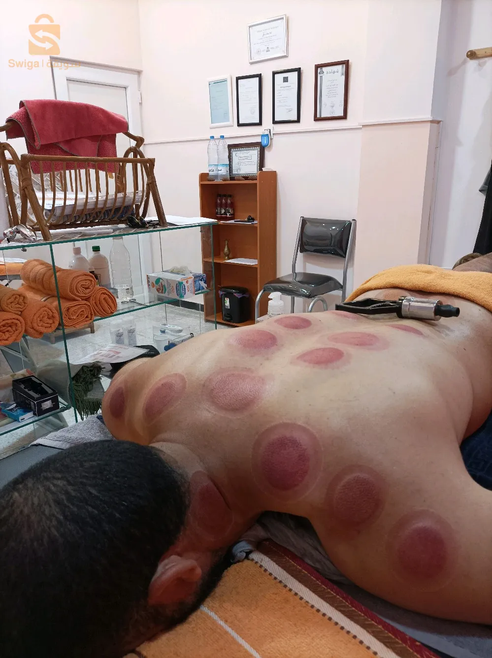 حجامة علاجية للرياضيين