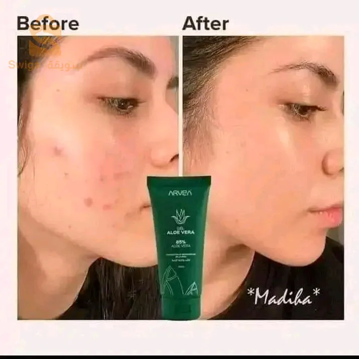 عناية بالبشرة