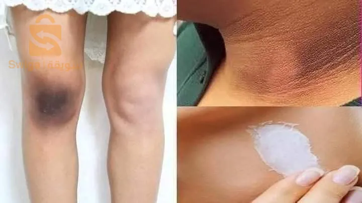 كريم ميلانو الطبي