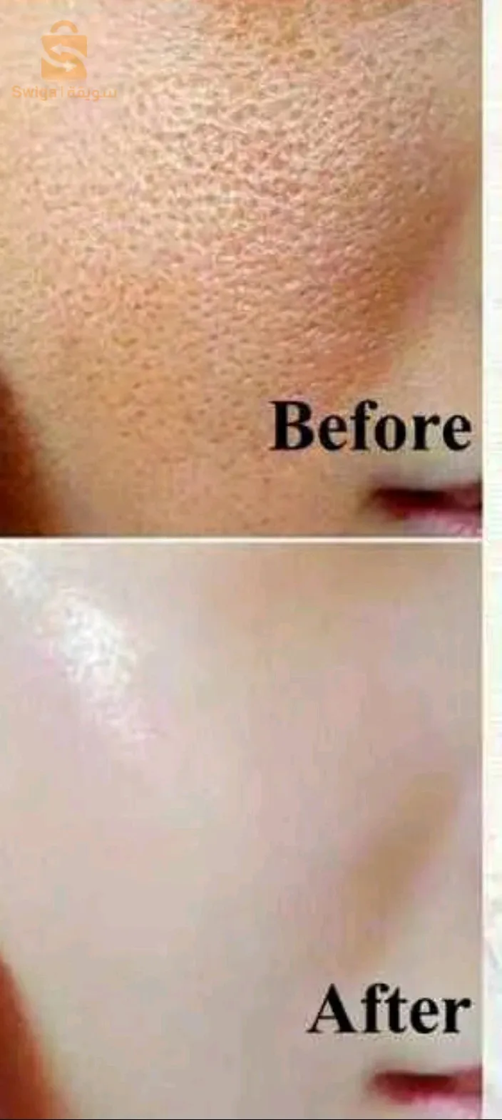 سيرم المعجزة يزيل البقع وانمسامات الواسعة مبيض للبشرة منتوج يصلح للبشرة الحساسة وكل ونواع البشرة  مضمون 100/100