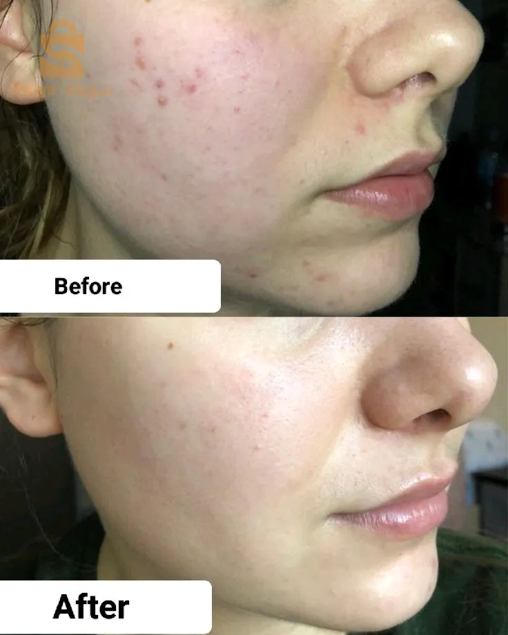 كريم كوري السحري مع صابونه الاصلي