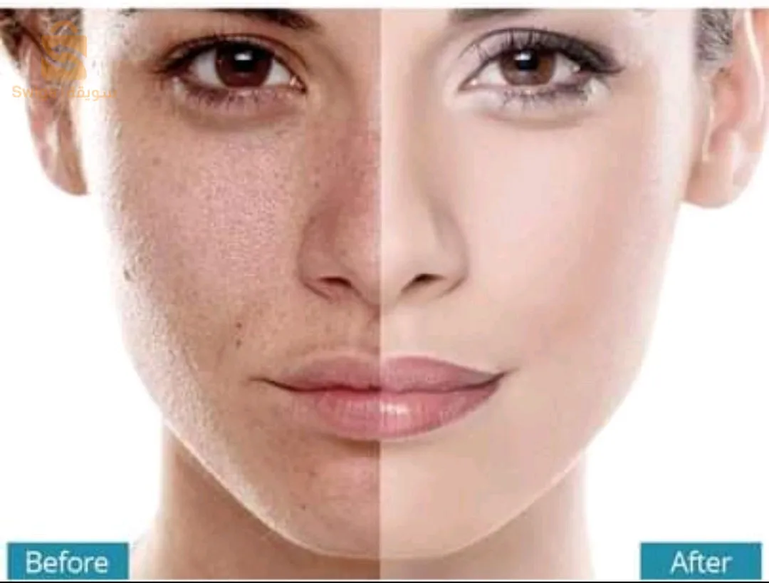 سيرم المعجزة يزيل البقع وانمسامات الواسعة مبيض للبشرة منتوج يصلح للبشرة الحساسة وكل ونواع البشرة  مضمون 100/100