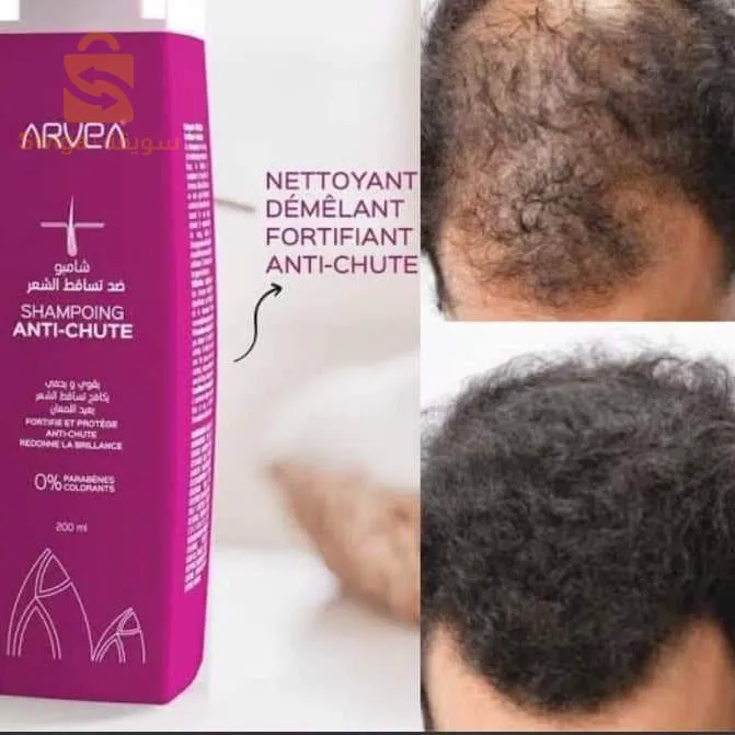 Des produits naturels sont disponibles 🥇✨ avec de multiples certificats pour le soin, par exemple, des cheveux et de la peau, un inhibiteur des douleurs articulaires, un médicament pour épaissir les cheveux et les pointes fourchues, en plus du savon pour soigner le visage et le corps des cellules mortes, impuretés, cernes, contactez-nous.