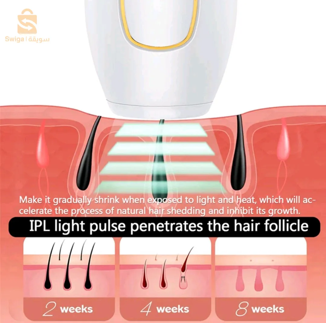 Home laser hair removal