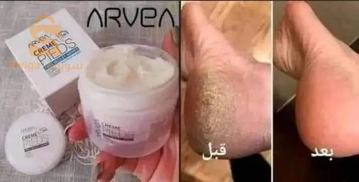 أرفيا نتور