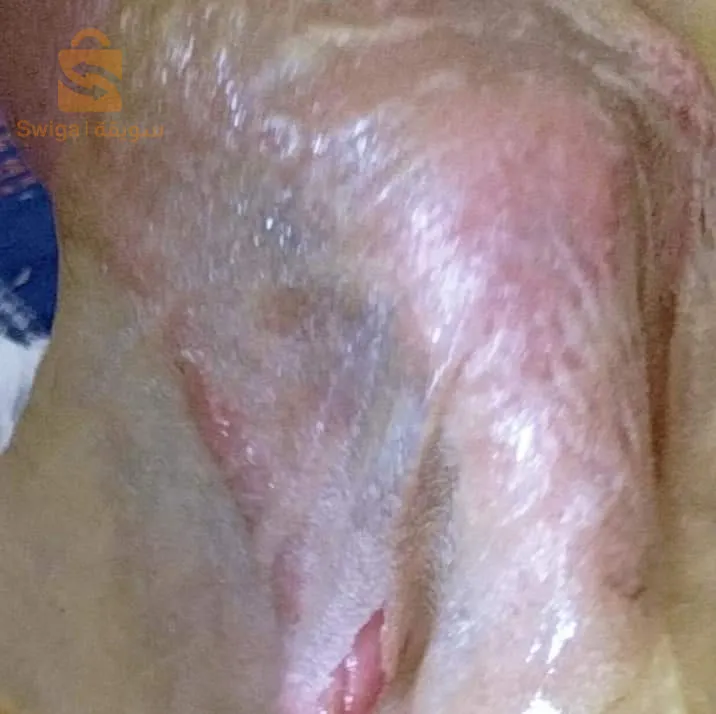 شخشوخة مسمن طمينة