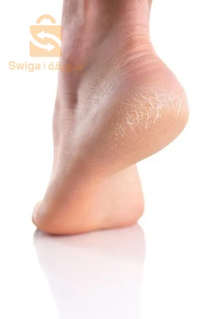 With this product, say goodbye to cracked feet 🦶🏻💧🪄
