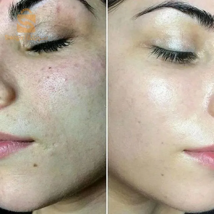 Pack pour peaux sèches et sensibles🧴💆🏻♂️💆🏻♀️