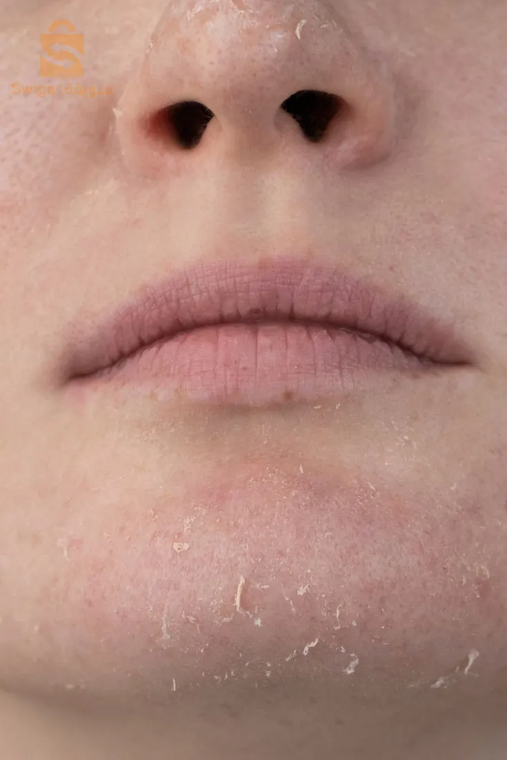 باك للبشرة الجافة و الحساسة..🧴💆🏻‍♂️💆🏻‍♀️