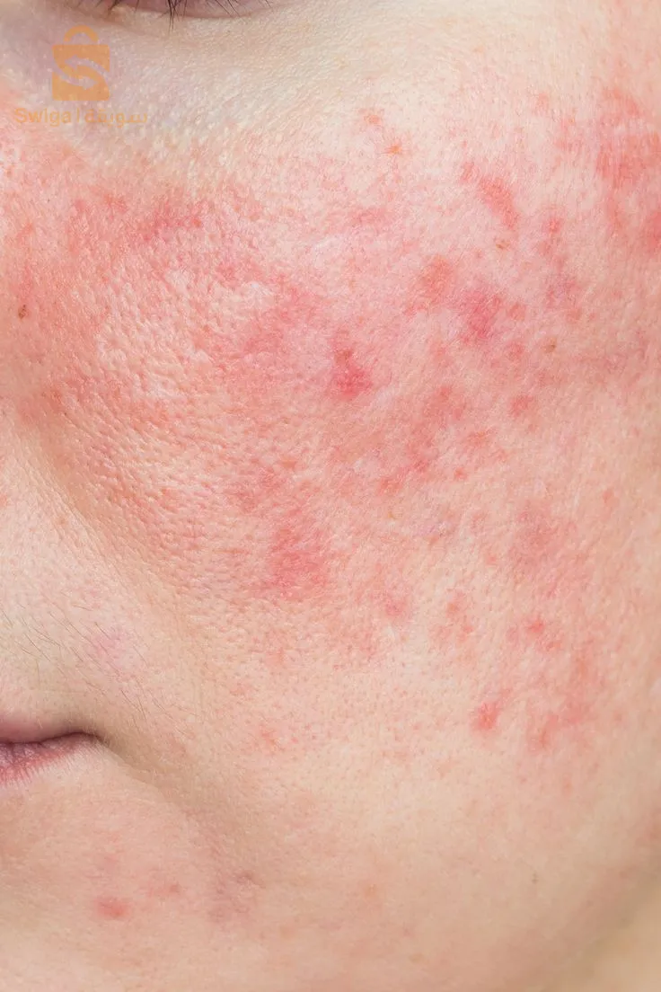 تمتعي ببشرة ناعمة و رطبة مع جال الألبوفيرا و ايتفيدي من باقي خصائصه✨️🍐