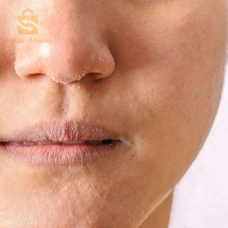 باك للبشرة الجافة و الحساسة..🧴💆🏻‍♂️💆🏻‍♀️