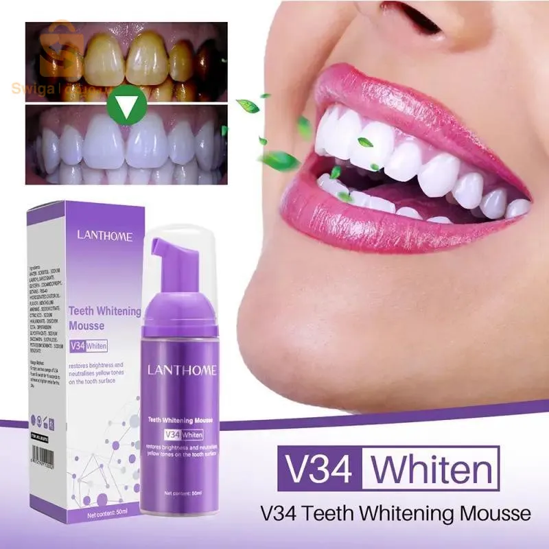 v34 teeth whitening