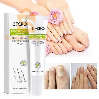 NAil treatment معالجة اضافر