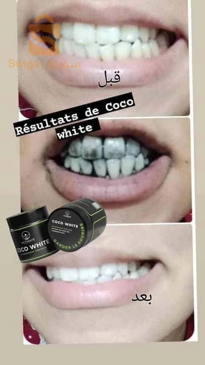 COCO WHITE