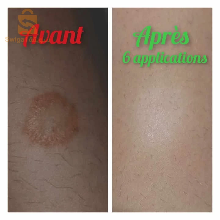 مراهم وخلطات طبيعية
