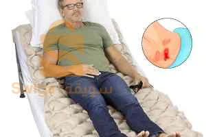 فراش مكافحة القرحة