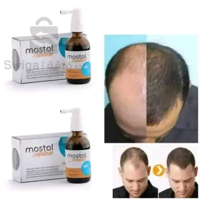 traitement de chute de cheveux