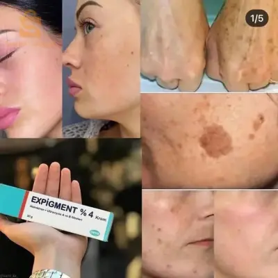 Expigment crème (30g)