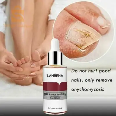 Le sérum de réparation des ongles LANBENA traite les champignons élimine la desquamation et la desquamation des ongles, des soins des mains et des pieds