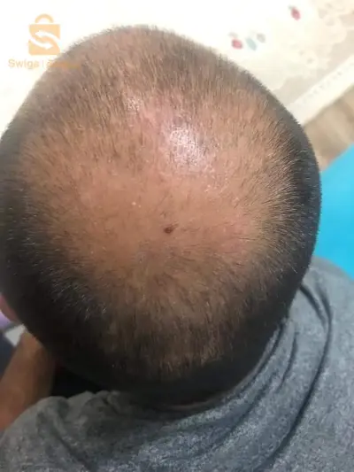 منتوج طبيعي 100% لتقوية الشعر والحد من تساقطه في وقت وجيز