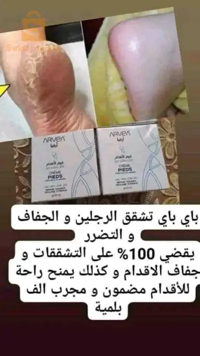كريم القدمين لقدمين أكثر تشقق