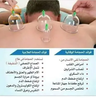 حجامة وقائية / علاجية  ؛ لتحسين الدورة الدموية ، تحفيز المناعة ،  علاج آلام الرأس ، الصداع ، الصداع النصفي ( الشقيقة) ، القولون العصبي ، ارتفاع ضغط الدم ، الخلعة ، اختلالات الجهاز الهضمي ، آلام الظهر ، آلام الرقبة ، عرق النسا ....... و كثير من الفوائد الأخرى
بإشراف خبراء  يتنقلون إليكم حيثما  كنتم
لحجز موعد  اتصل على 0656376931

أيام  العمل : الأحد ، الإثنين ، الثلاثاء ، الخميس.

العاصمة / بومرداس