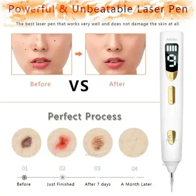 Stylo d'élimination des taupes au laser plasma pour enlever les taches de rousseur de la peau du maïs et les verrues électrique Dark Tag Nevus Pimple Spot Tattoo Traitement anti-rides