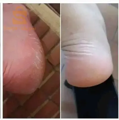 كريم الاقدام