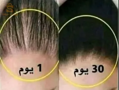 خلطة براري العجيبة الاصلية