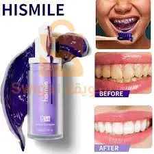 احصلي علي إبتسامة هوليوود مع مبيض الأسنان الجديد Hismile