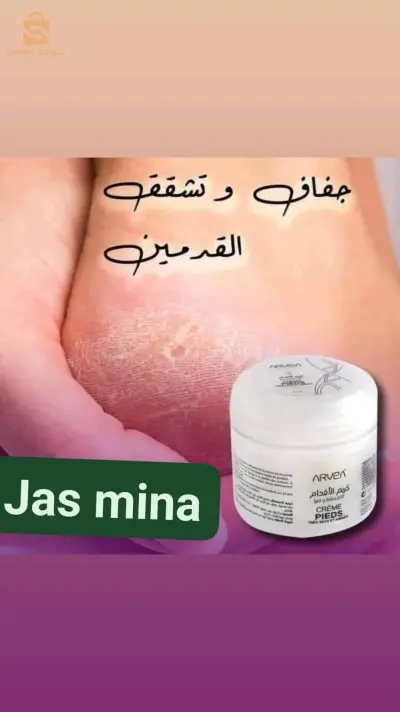 كريم تشقق الأقدام
