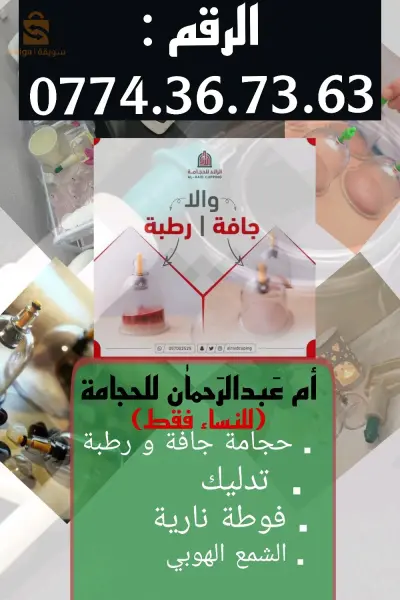 أم عَبدالرَحماٰن لِلحِجامَة (للنساء فقط)