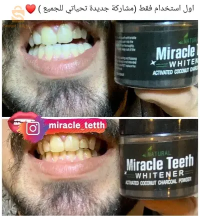Miracle Teeth Whitener