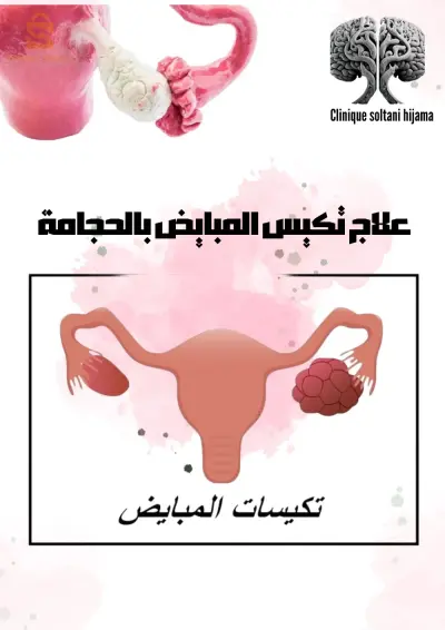 عبادة د.سلطاني للحجامة و الطب البديل سيدي بلعباس