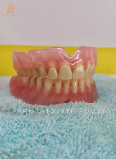 Salam je suis prothésiste dentaire spécialité amouvible (Dentier) déplacement pour consultation 2000 da