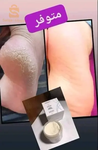 crème des pieds