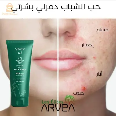 Gel aloe vera arvea (100ml)