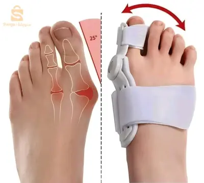 مصحح اعوجاج اصبع القدم