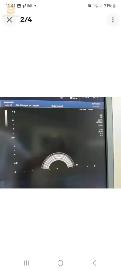 vends sonde endo-vaginale 4D toshiba